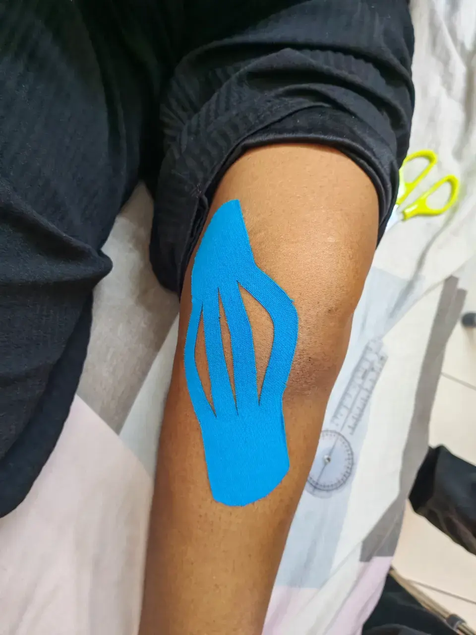 Kinesiology tape applied during physiotherapy treatment